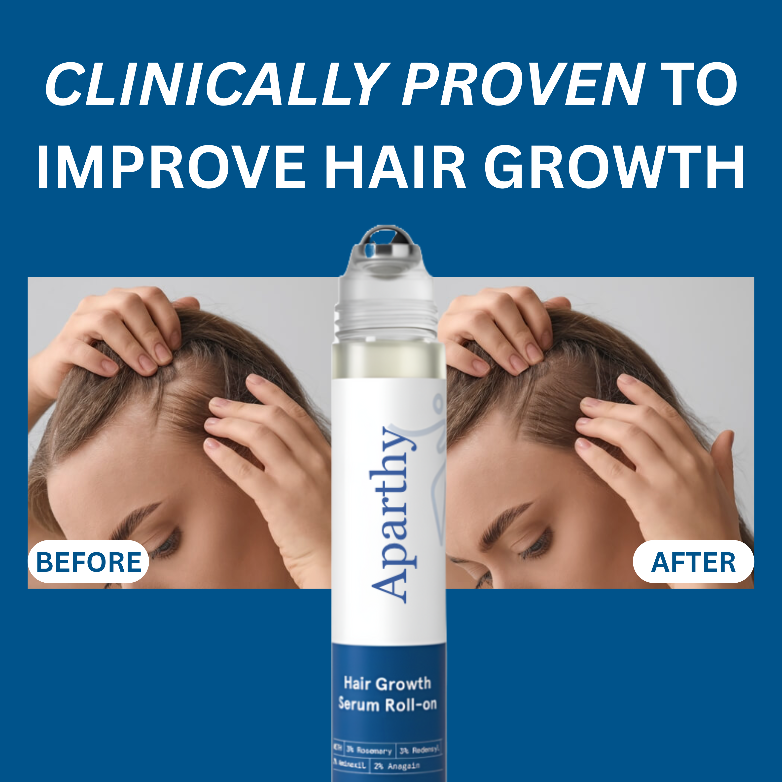 【🔥Hot gate promotion】Aparthy Hair Growth Roll on Serum - Image 5